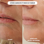 Micro Infusion Anti Âge