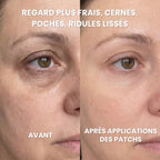 Patchs Hydrogel Anti-Cernes - Caféine, Collagène, Niacinamides