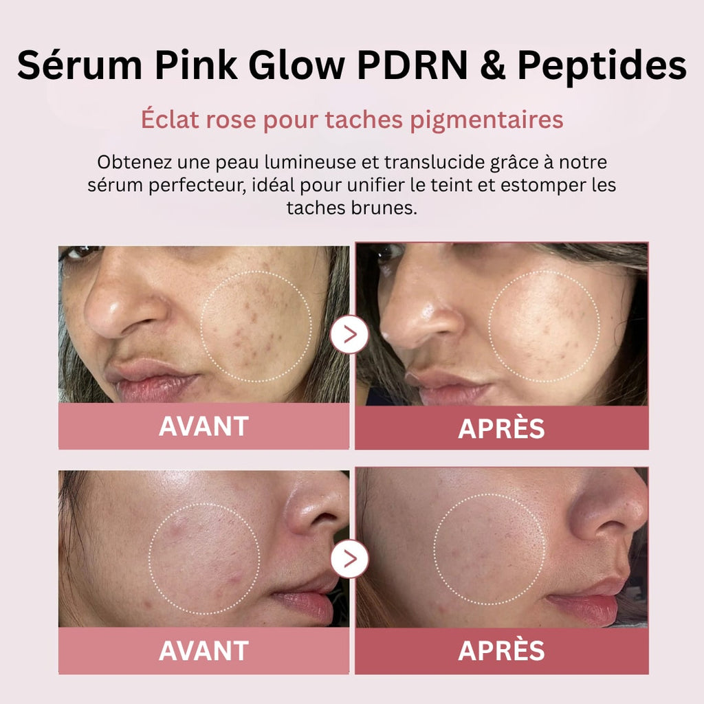 Sérum Pink Glow PDRN