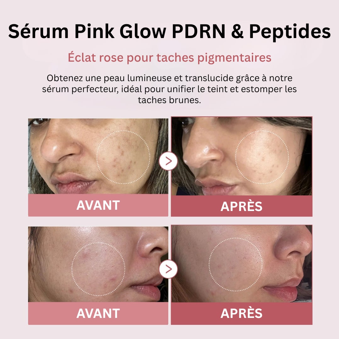 Sérum Pink Glow PDRN